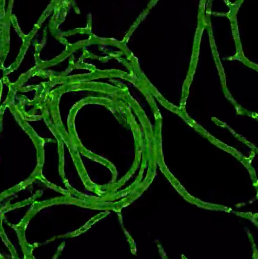 Abundance  of  fungal  hyphae  in  seawater  by  epifluorescence  microscopy  using  Calcofluor  White  stain  method