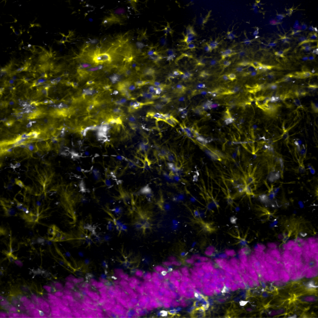 IHF AEGING GFAP + Iba1 + NeuN