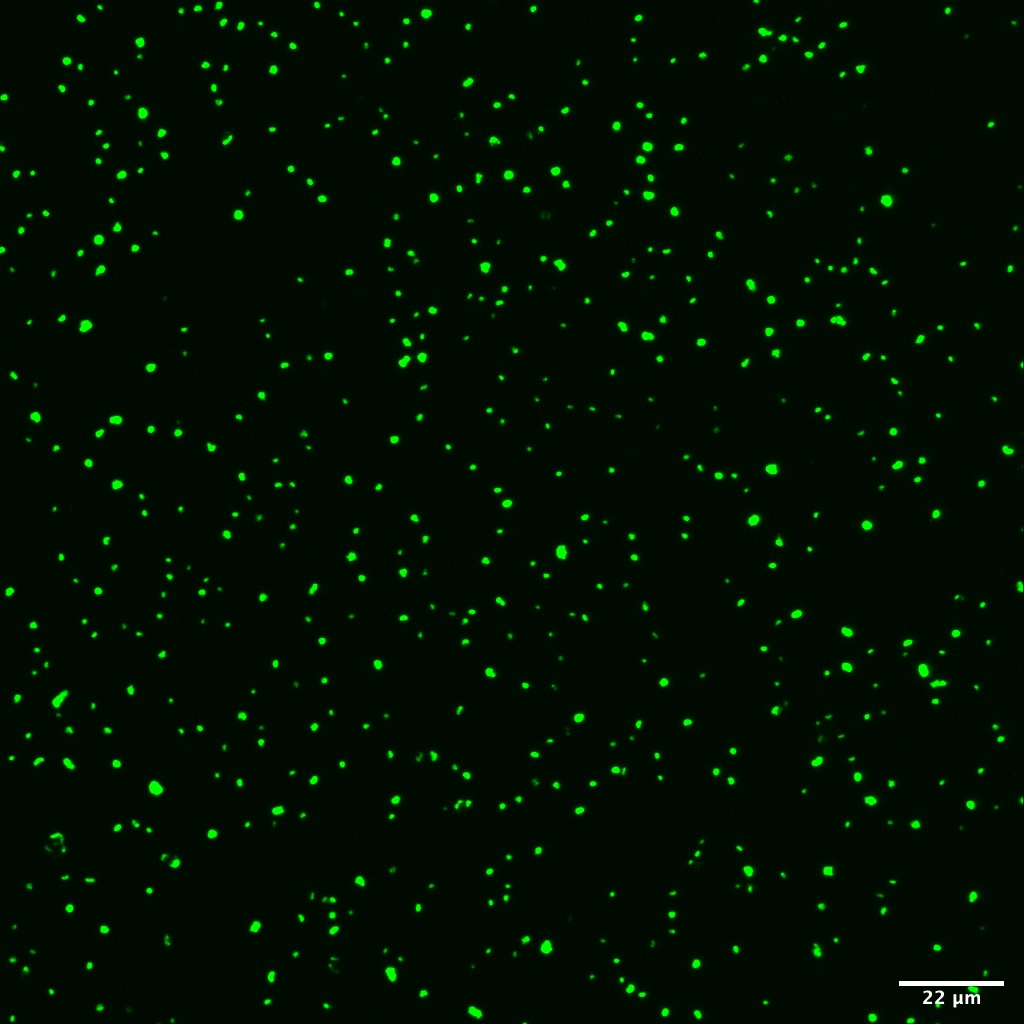 Catalyzed reporter deposition fluorescence in situ hybridization (CARD-FISH)