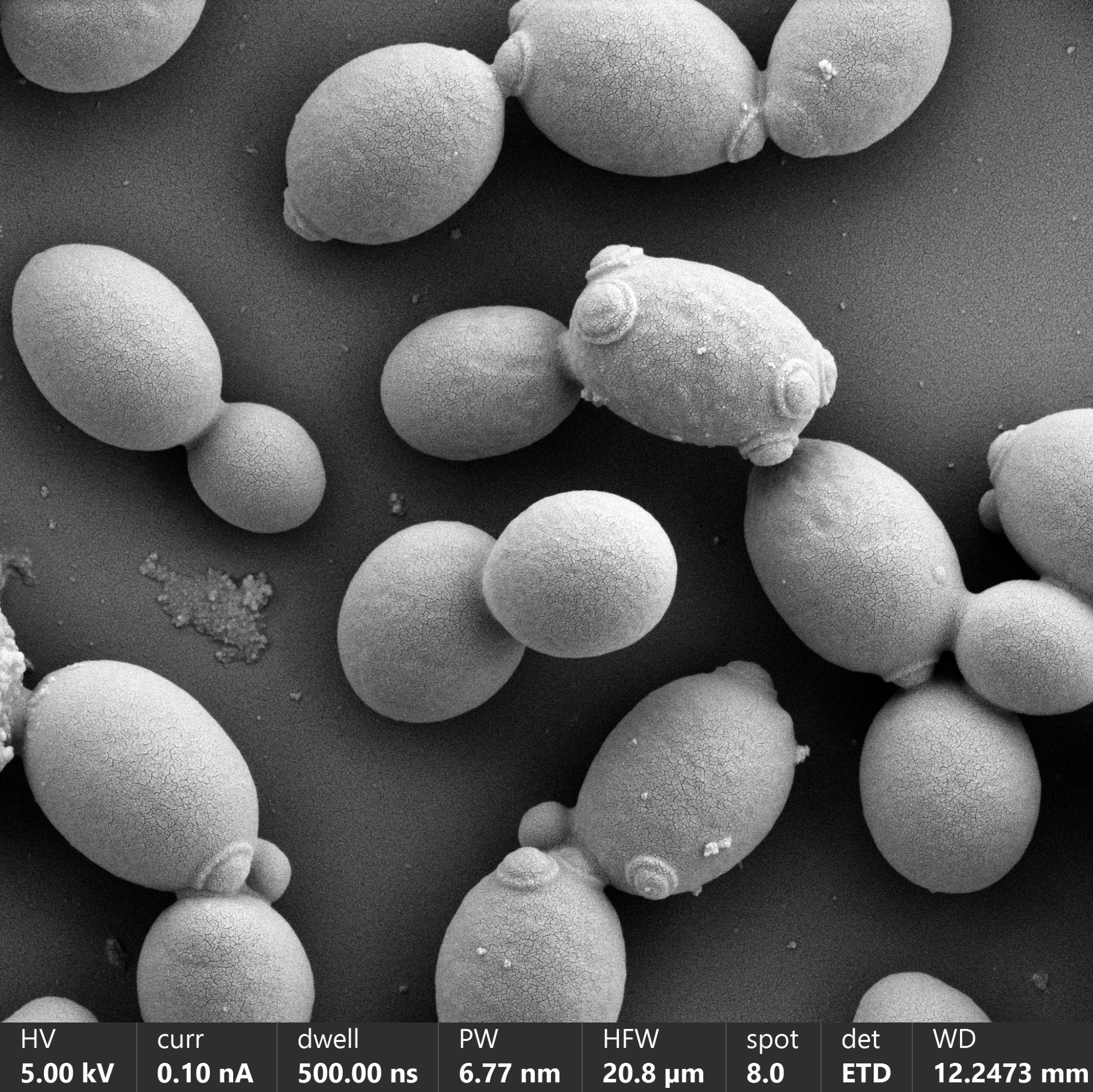 Yeast suspension for SEM (with HMDS)