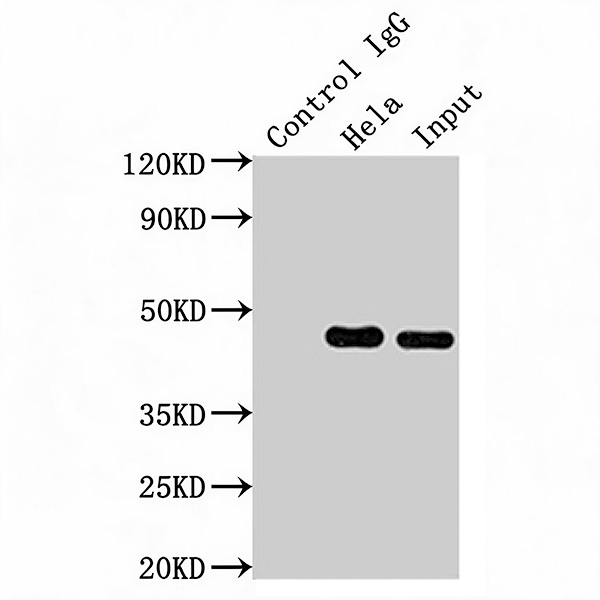 Immunoprecipitation (IP) Protocol for MAP2K1 Using MAP2K1 Recombinant Monoclonal Antibody (CSB-RA957619A0HU)