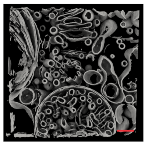Tomogram reconstruction and pre-processing using standardized workflow in Scipion-EM
