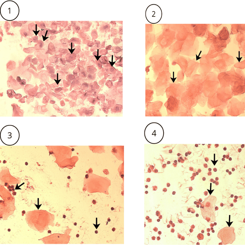 Protocol for Hematoxylin and Eosin Staining in Vaginal Cytology
