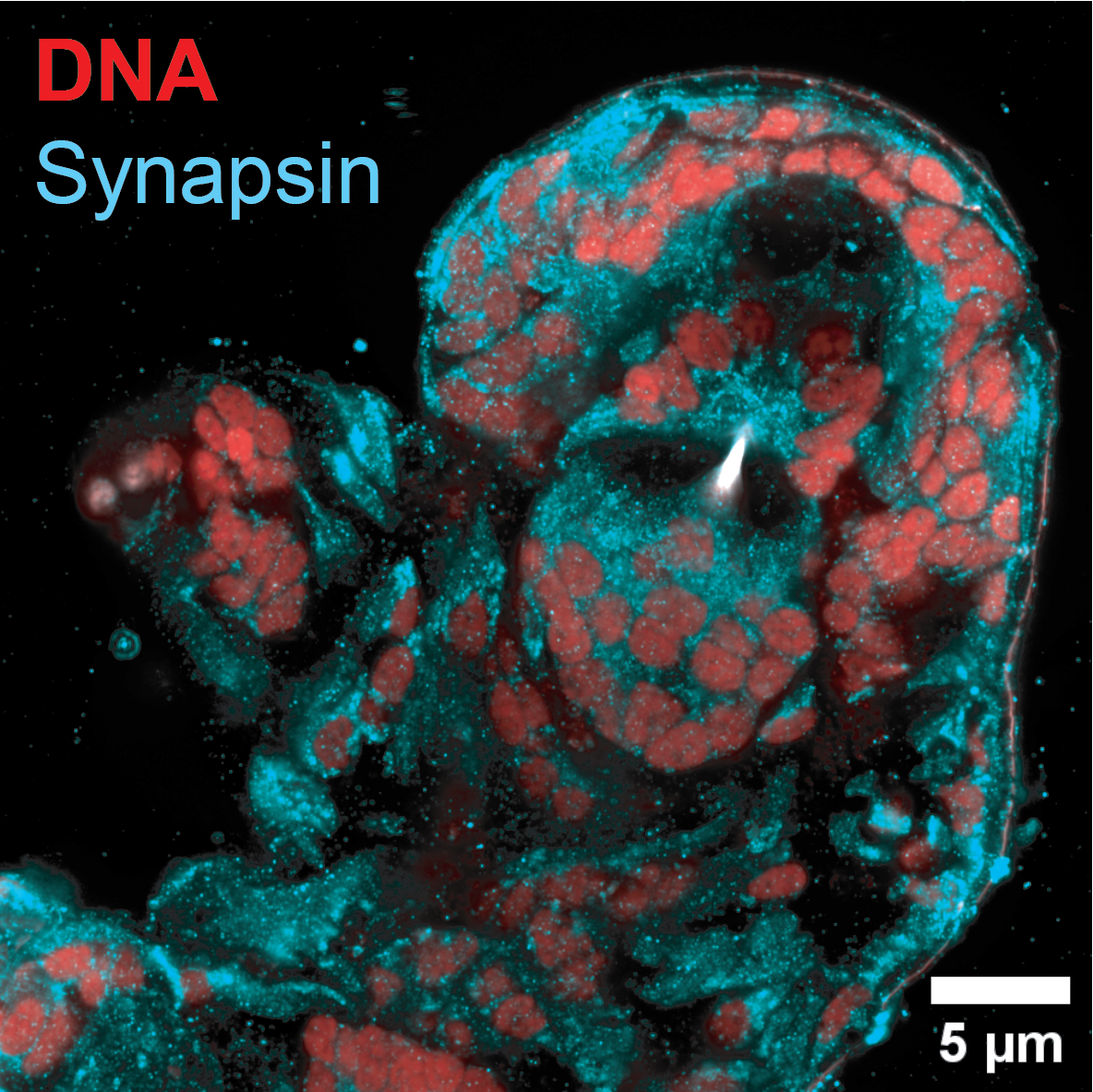 Cryo-Expansion Microscopy of C. elegans and Tardigrades
