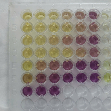 DPPH radical scavenging capacity by extract plants