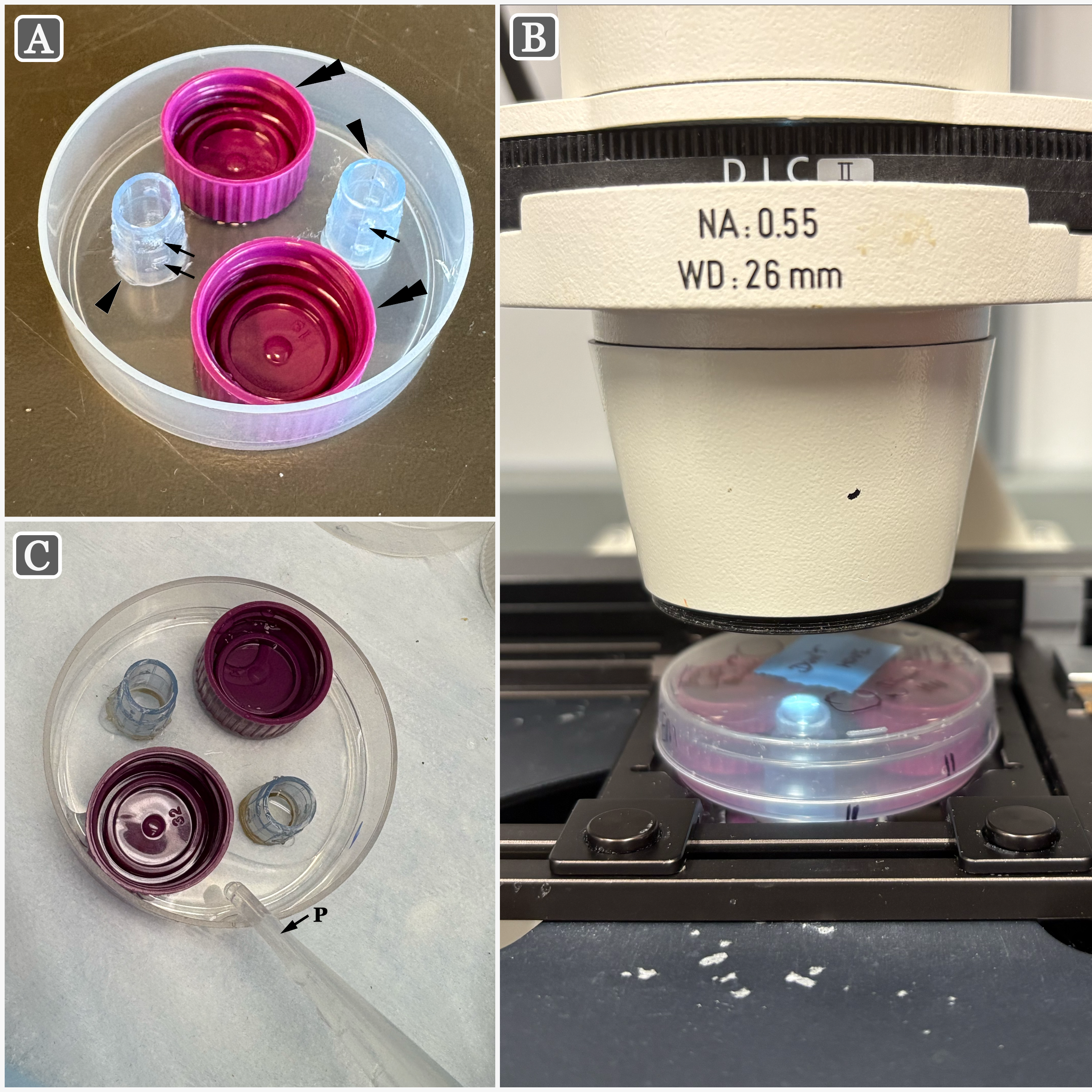 Single–Cell Transmission Electron Microscopy (TEM)