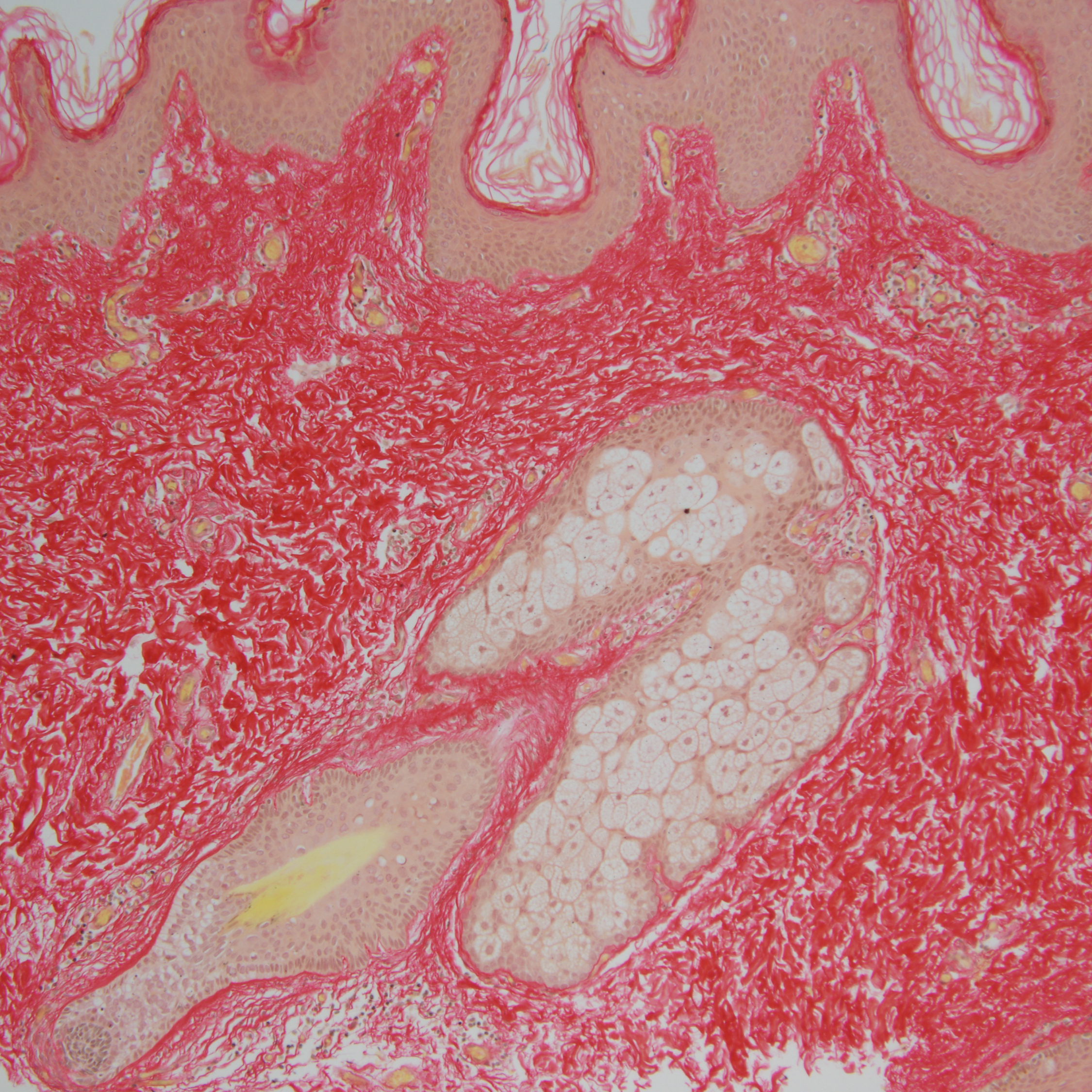 Picrosirius red staining for histology