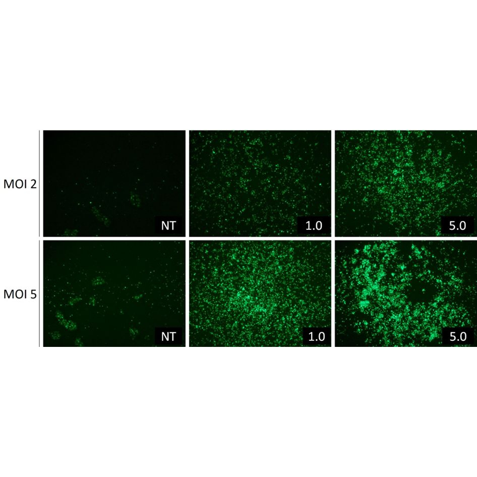 LentiBlast Premium Lentiviral transduction enhancer
