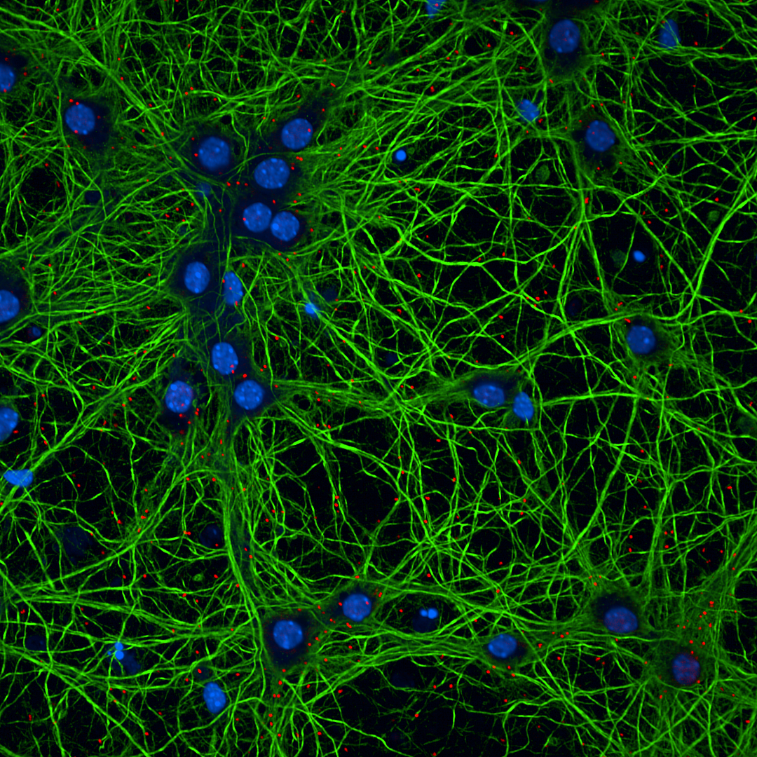 Quantification and Limitations of PSD95-NR2B Clustering using Proximity Ligation Assay in Primary Neuronal Cultures