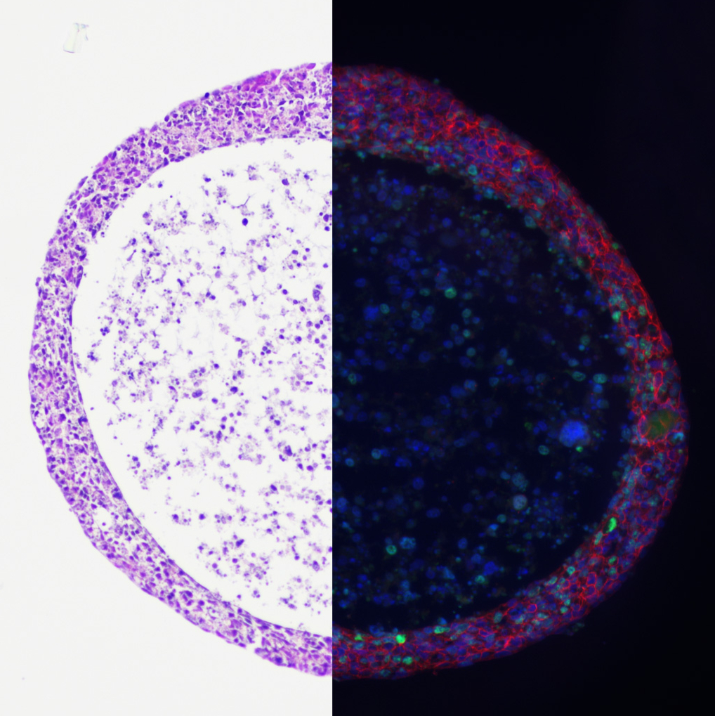 Preparation of cryo- and paraffin sections of spheroids for histological and immunofluorescence analysis