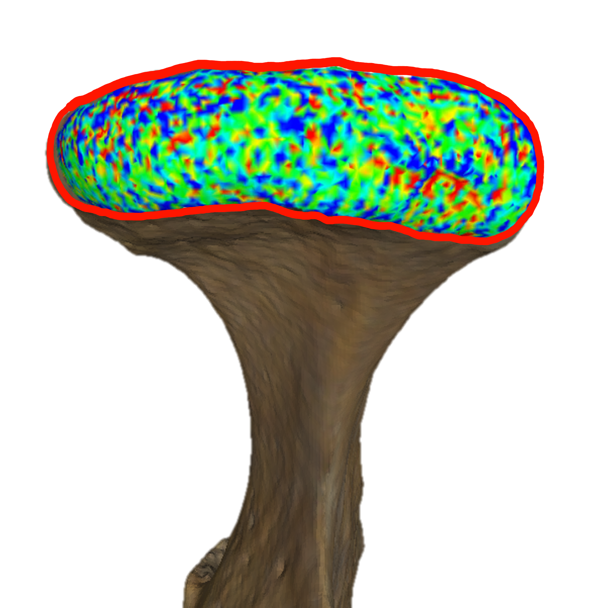 Measurements of the condylar surface area of TMJ in 3D