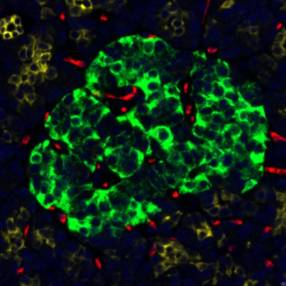 GeoMx Digital Spatial Profiler Immuno-oncology (IO) Proteome Atlas (IPA) Assay for Human Pancreas