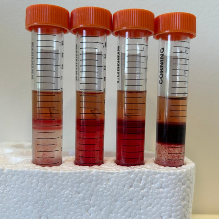 Gametocyte enrichment methods: MACS & Percoll 