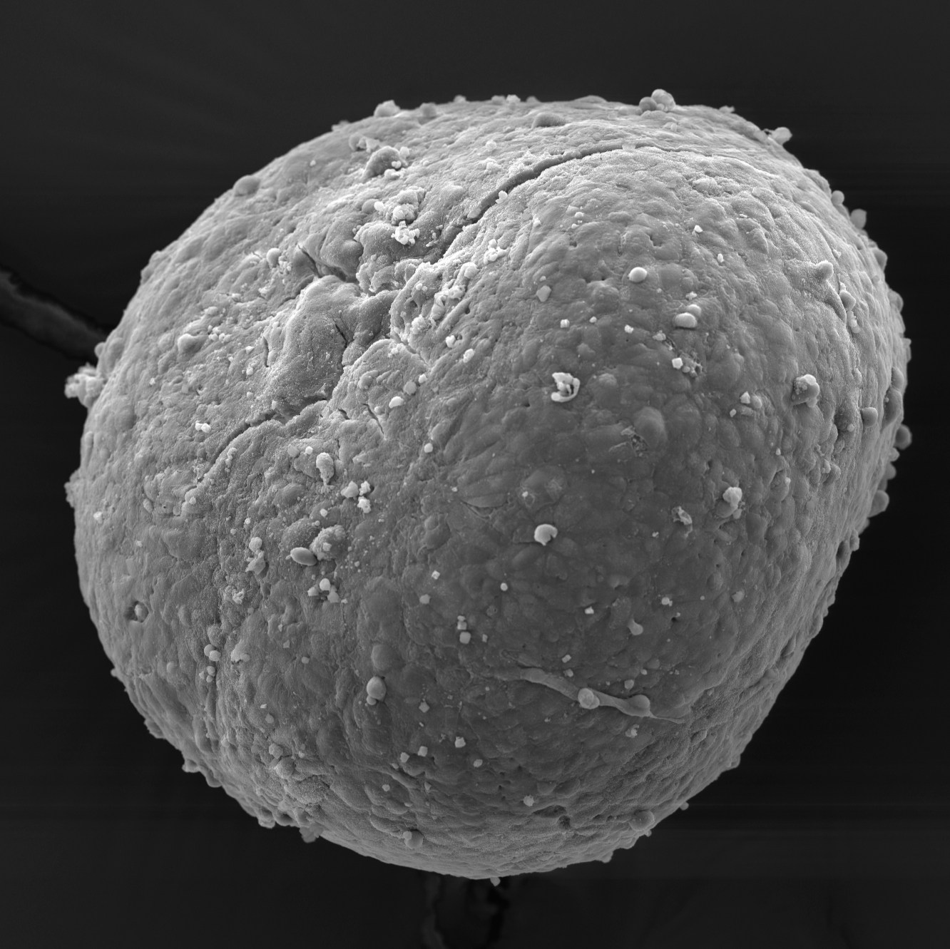 Preparation and gold sputter coating of whole-mount spheroids for scanning electron microscopy analysis