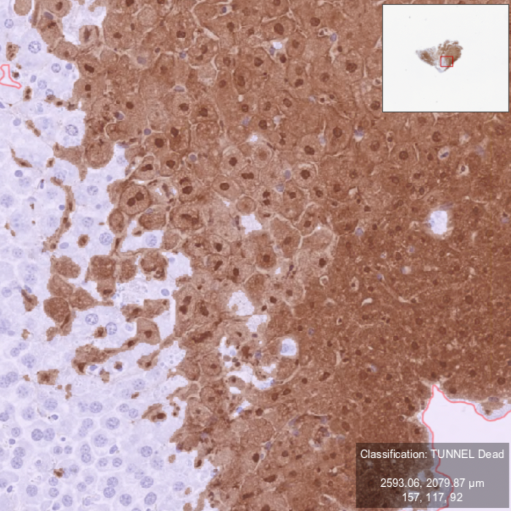 QuPath Stain Quantification of Whole Tissue by Percent Area