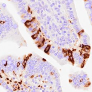 Immunohistochemical detection of porcine epidemic diarrhea virus (PEDV) in formalin-fixed, paraffin-embedded (FFPE) pig tissues