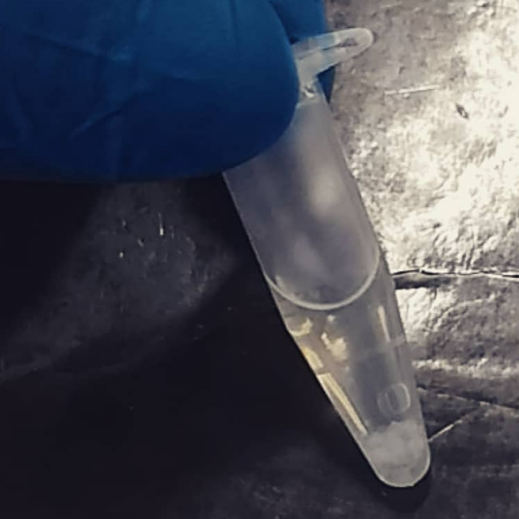 Bacterial Nucleic Acid Extraction Protocol Adapted for a Resource-Limited Setting