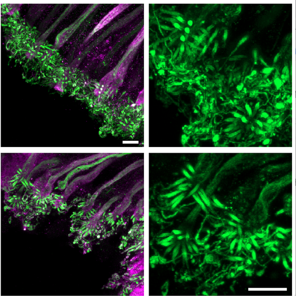 A 4-5X expansion microscopy protocol for high‑resolution imaging of olfactory sensory neuron cilia in mouse olfactory epithelium