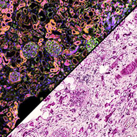 10X Xenium In Situ Gene Expression for Fresh-Frozen Kidney