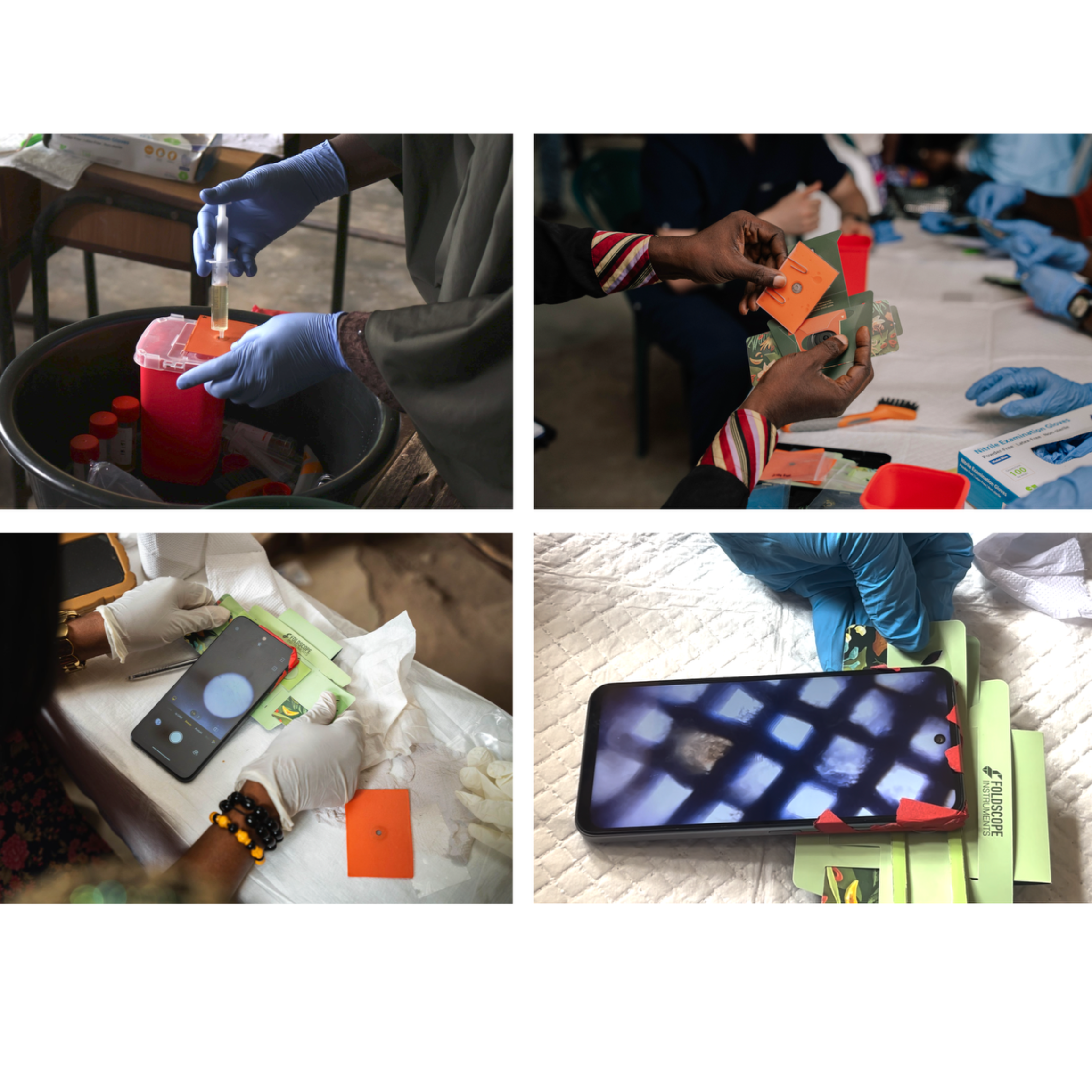 Protocol: Evaluation of a Low-Cost Point of Care (POC) Methods for Community-led Schistosomiasis Control: A Mixed-Methods Pilot Study