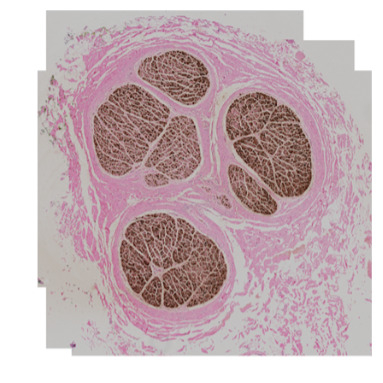 REVA #11: Histology and Immunohistochemistry (IHC) of Cadaveric Human Vagus Nerves