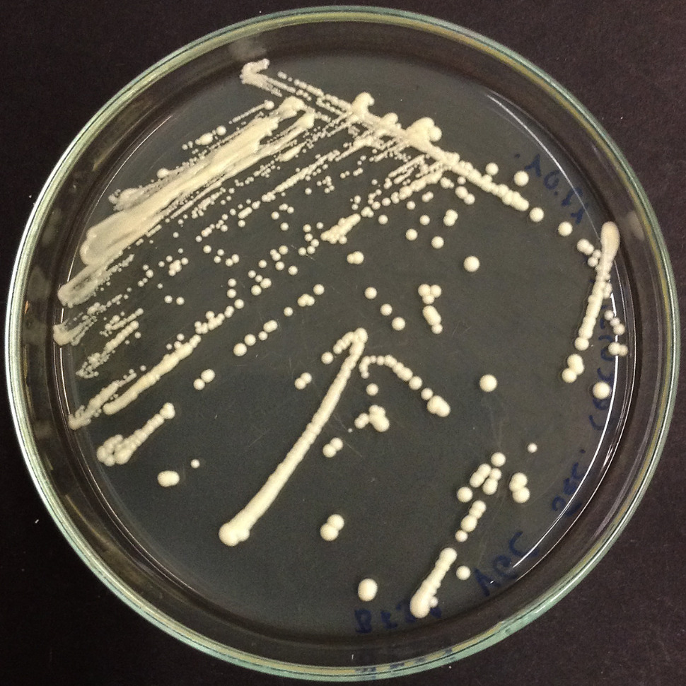 Agar Plate Preparation