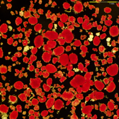 Human Islet Isolation Media Preparation