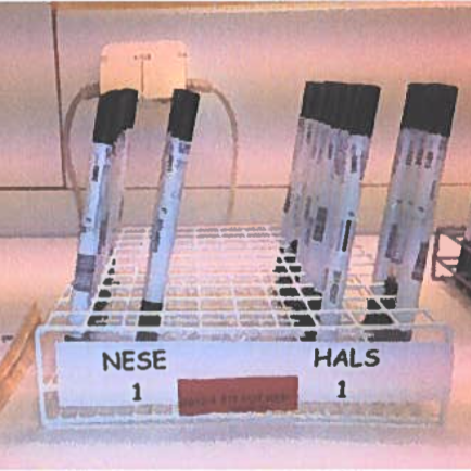 Protocol for sampling and transport of nose- and thoratsamples in the Fit Futures study