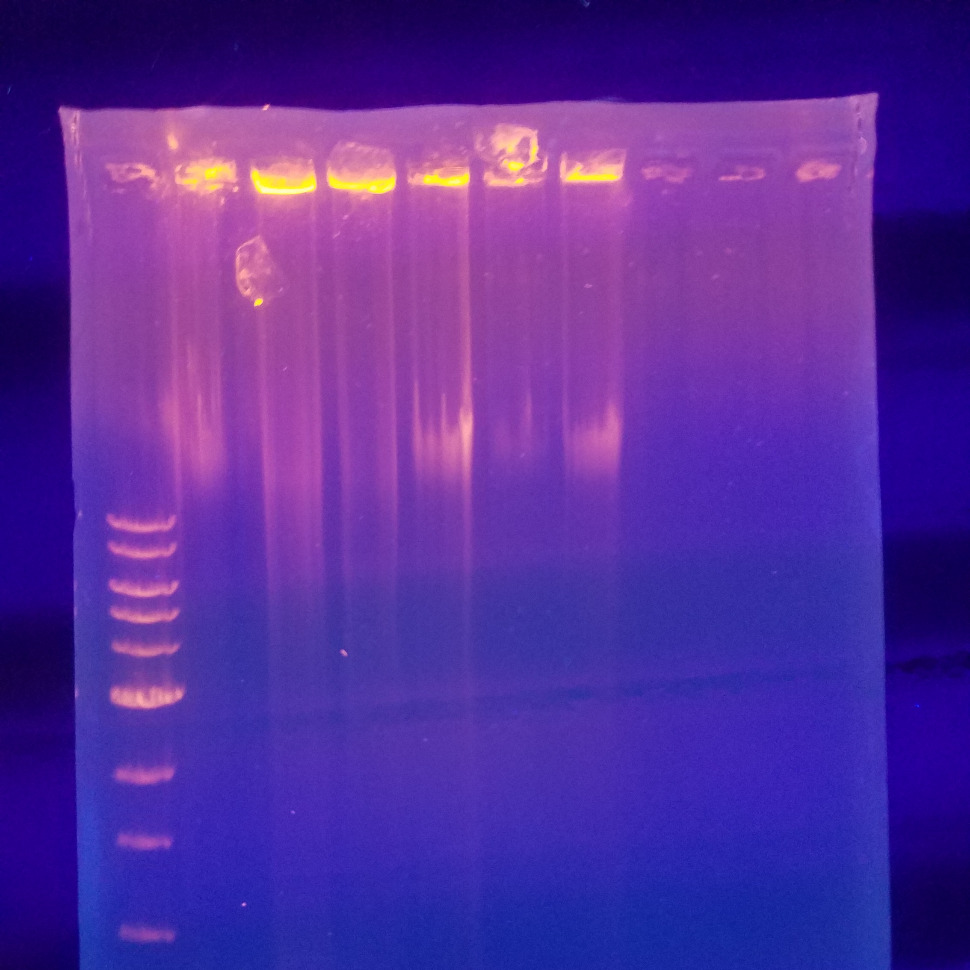Agarose Gel Electrophoresis