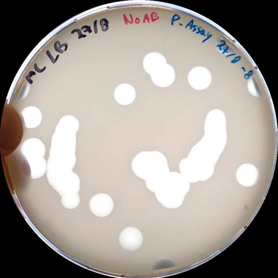 Plaque assay T7 bacteriophage, double agar method