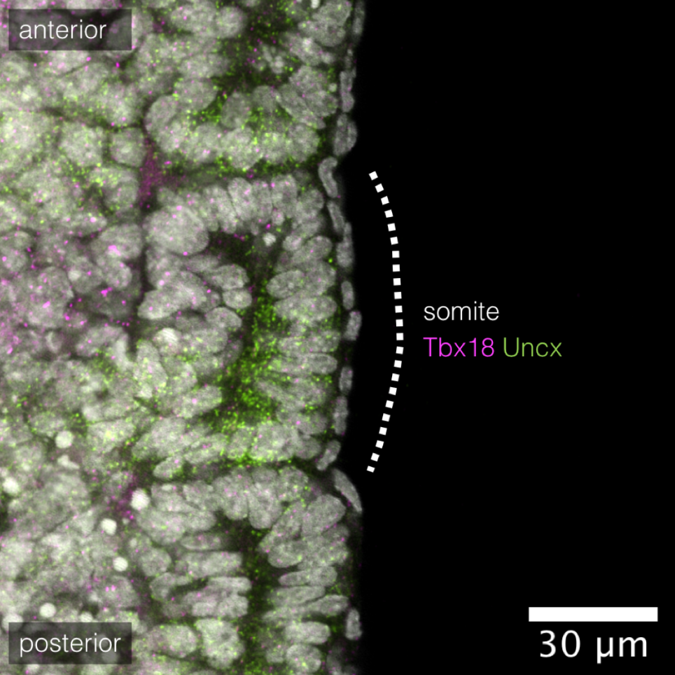 Hybridization chain reaction (HCR) protocol for tails of mouse embryos