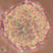 Neurasphere Neurosphere Protocol - A rapid and detailed method for the isolation of ...