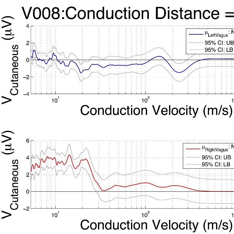A simple, non-invasive approach to detect vagal nerve response patterns that predict a positive treatment response to gastric electrical stimulation therapy for gastroparesis