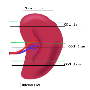 SOP Appendix for Spleen