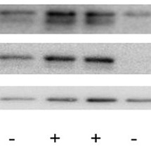 Brooks Lab Western Blotting Protocol