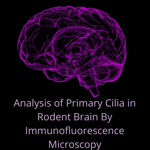 Analysis of Primary Cilia in Rodent Brain By Immunofluorescence Microscopy