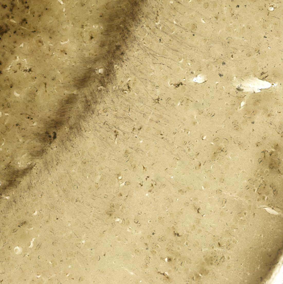 Gallyas-silver stain