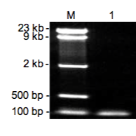 Zymoclean™ Gel DNA Recovery Kit