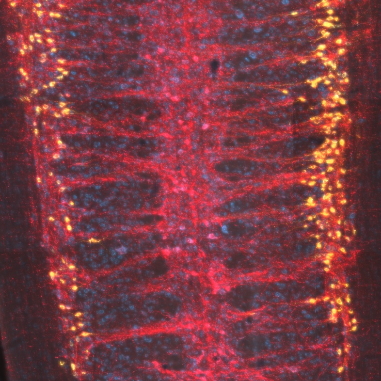 Use of cholera toxin subunit B to label neural projections to major pelvic ganglia