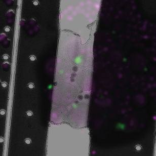 3D-correlative FIB-milling and Cryo-ET of Autophagic structures in Yeast Cells 