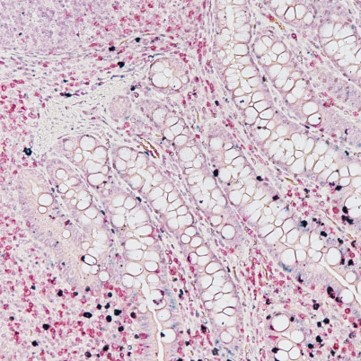 Dual staining for gamma delta and alpha beta T cell detection in formalin-fixed, paraffin-embedded (FFPE) pig tissues