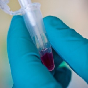 Casting of a polyacrylamide gel