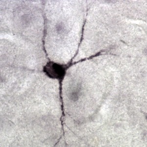 DCX Immunohistochemistry Protocol V.2