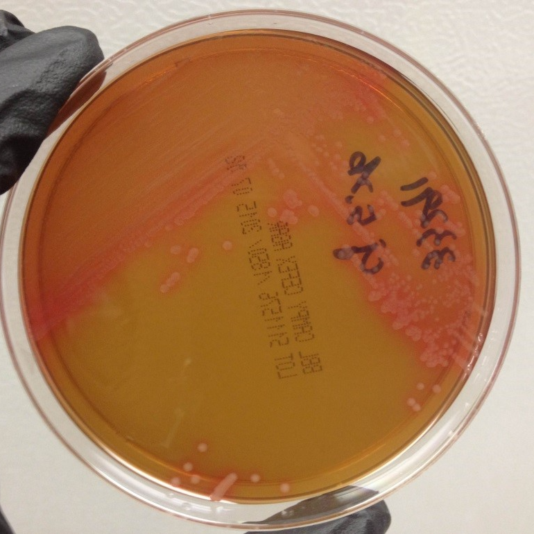 Campylobacter jejuni culture method