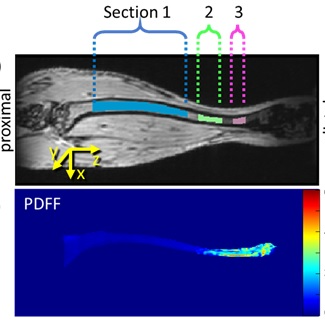Proton Density Fat Fraction (PDFF) Measurement of Myelofibrosis in Mouse Tibia