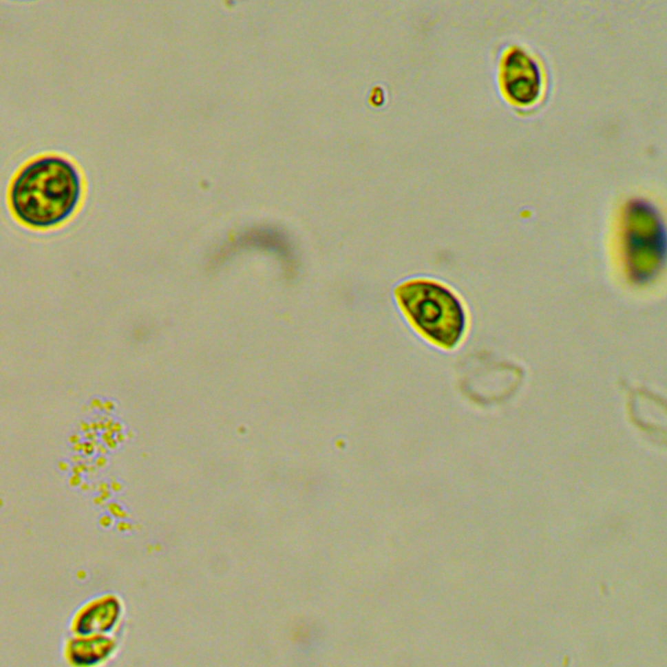 CTAB/Chloroform-Isoamyl Alcohol DNA Extraction Protocol