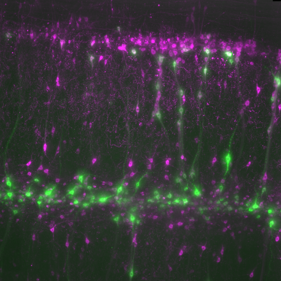 Immunolabelling and clearing of intact, fixed rat spinal cord for visualization of neurons projecting to major pelvic ganglion