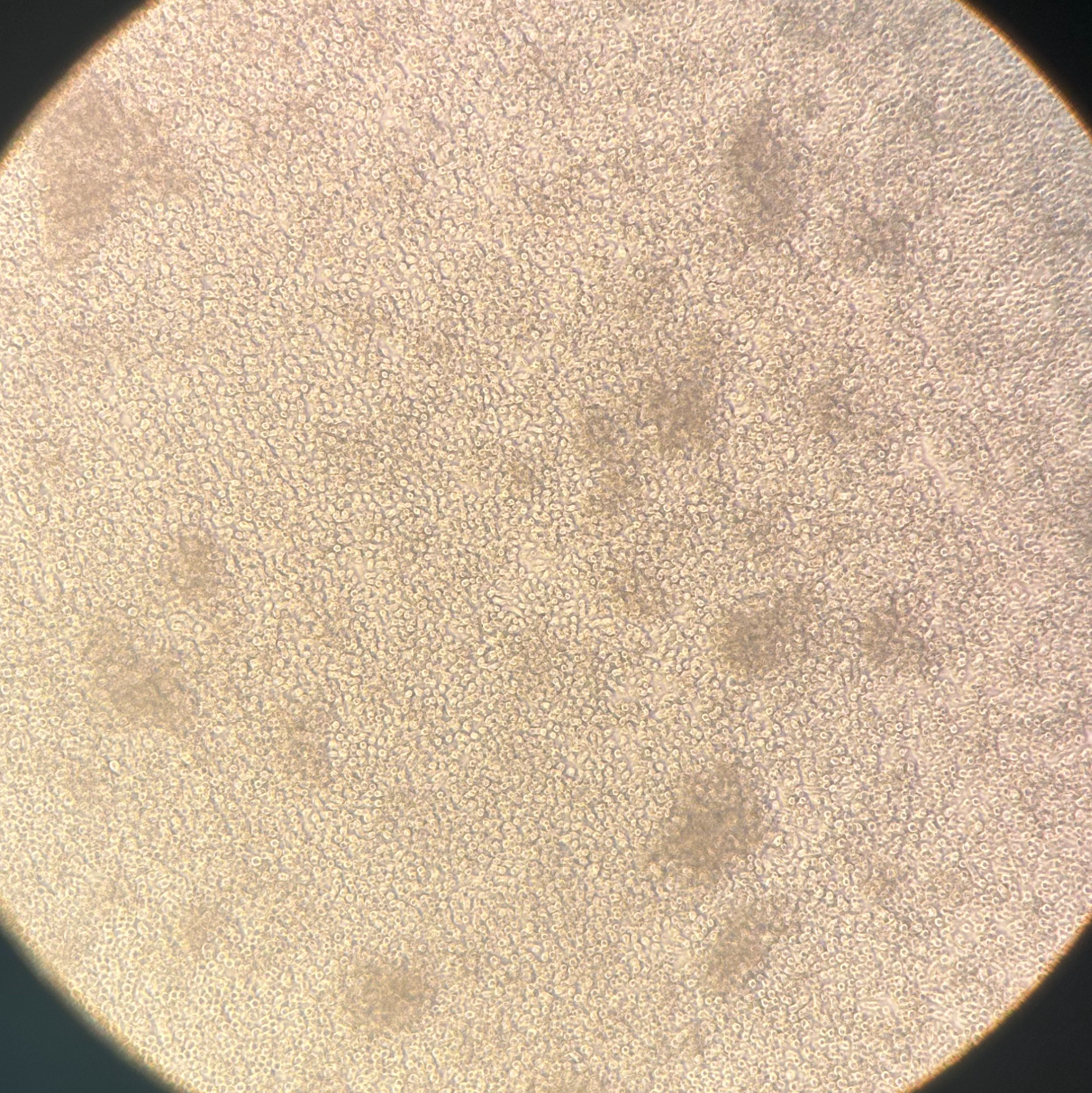 Mouse lung MAIT cell expansion and purification protocol