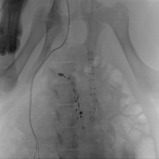 coloMOCA implantation protocol  