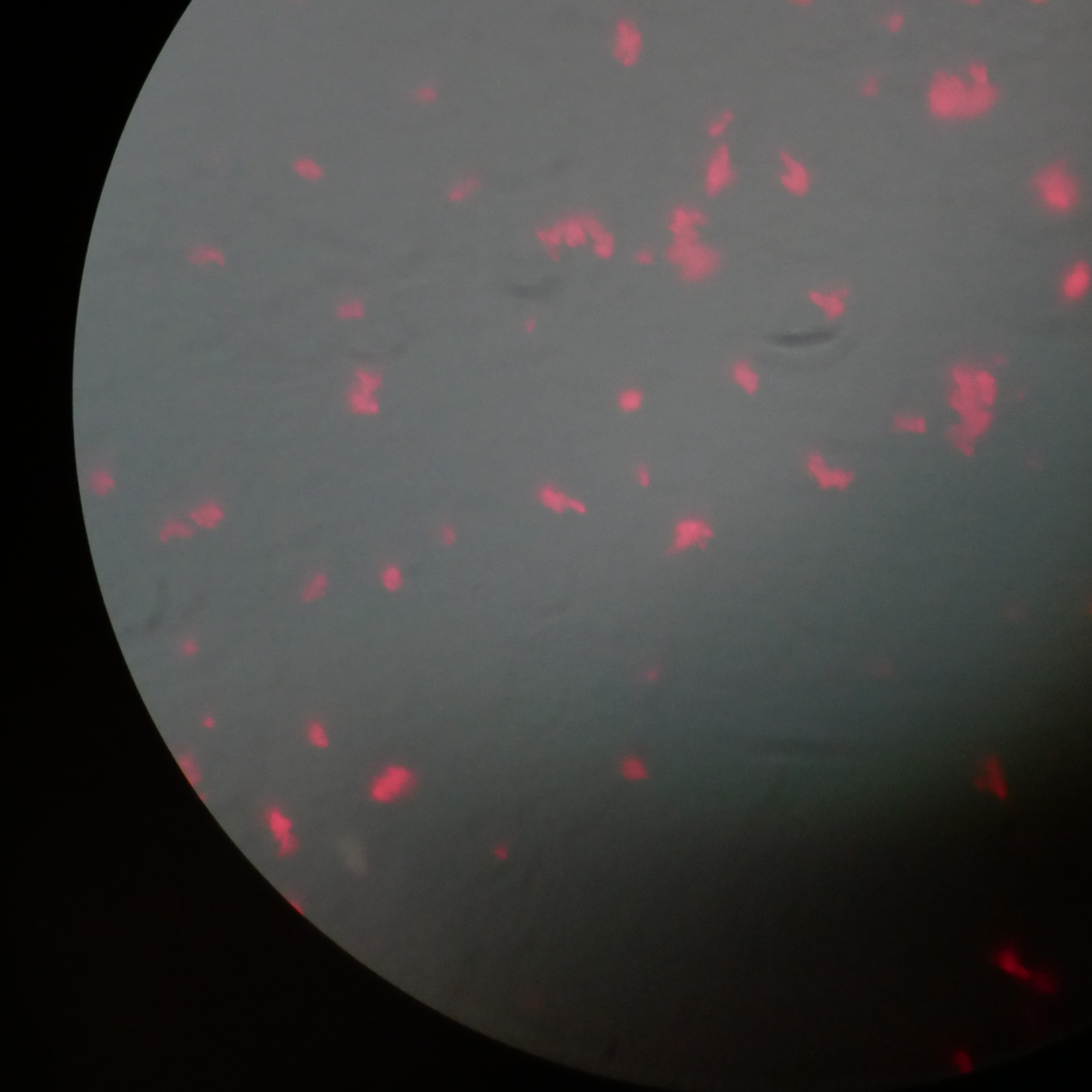 A simple and fast single step method to isolate and stain the CD27 B cells (plasma cells) with quantum dots magnetic beads antibody conjugate for fluorescent microscopy